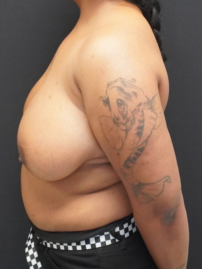 Before Image:  - left-side