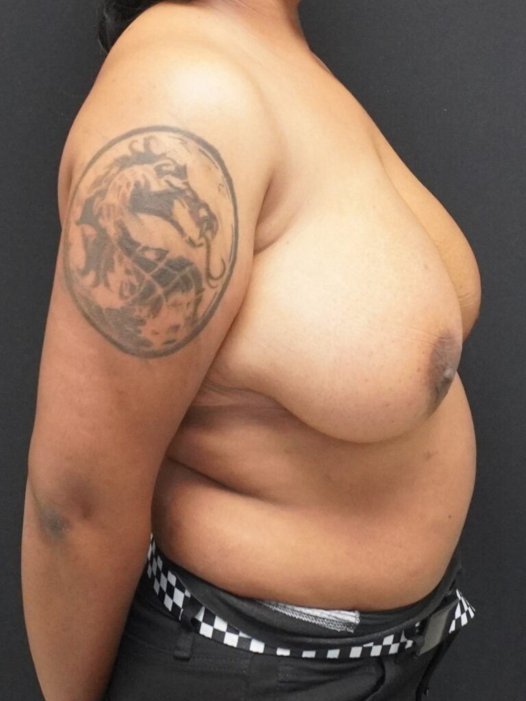 Before Image:  - right-side