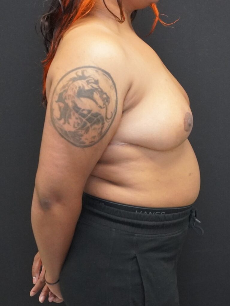 After Image:  - right-side
