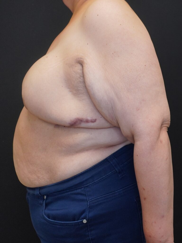 Before Image:  - left-side