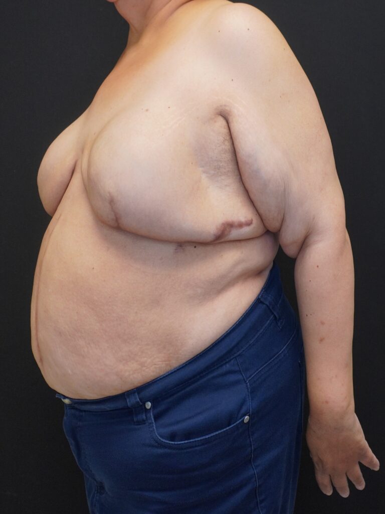 Before Image:  - left-front-oblique