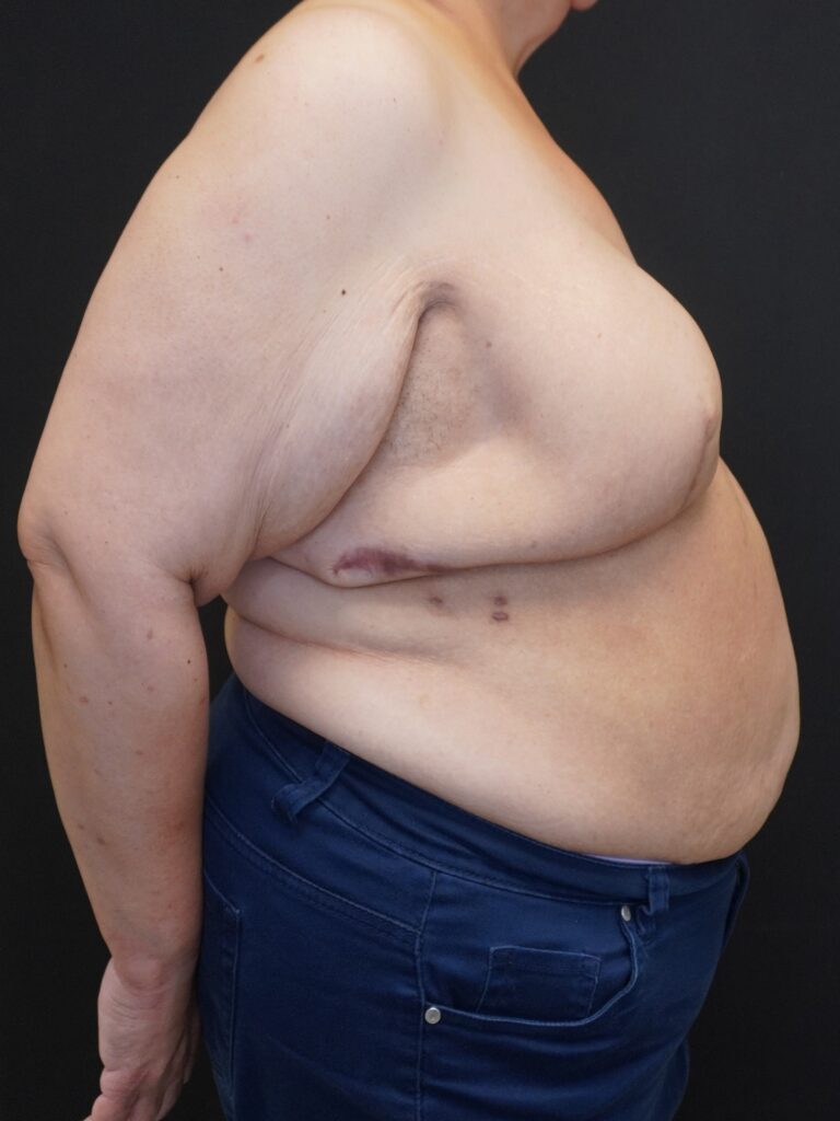 Before Image:  - right-side