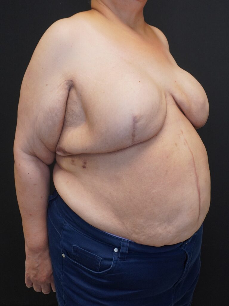 Before Image:  - right-front-oblique