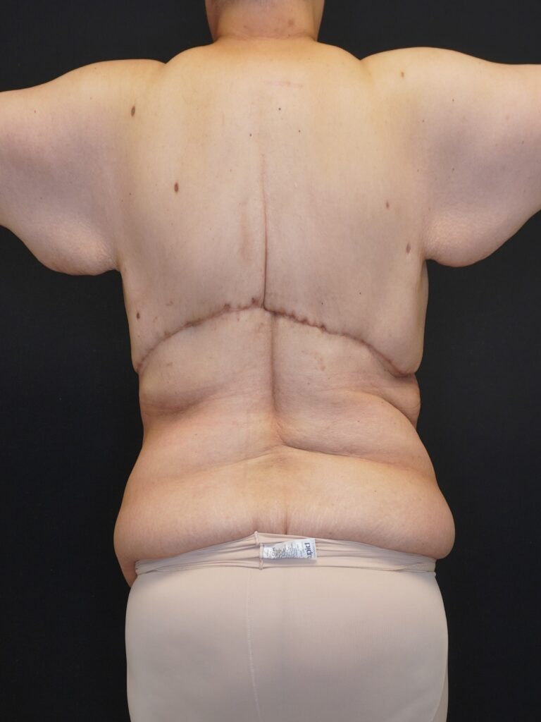 After Image:  - back