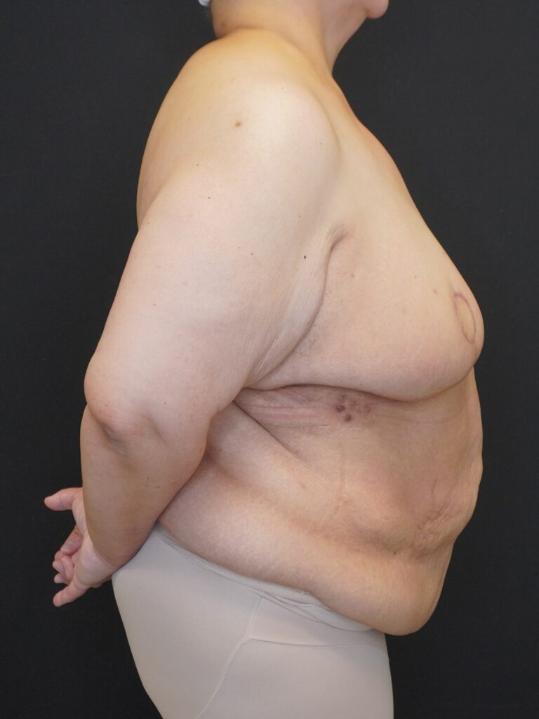 After Image:  - right-side