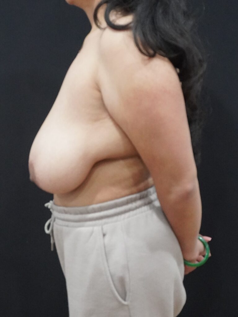 Before Image:  - left-side