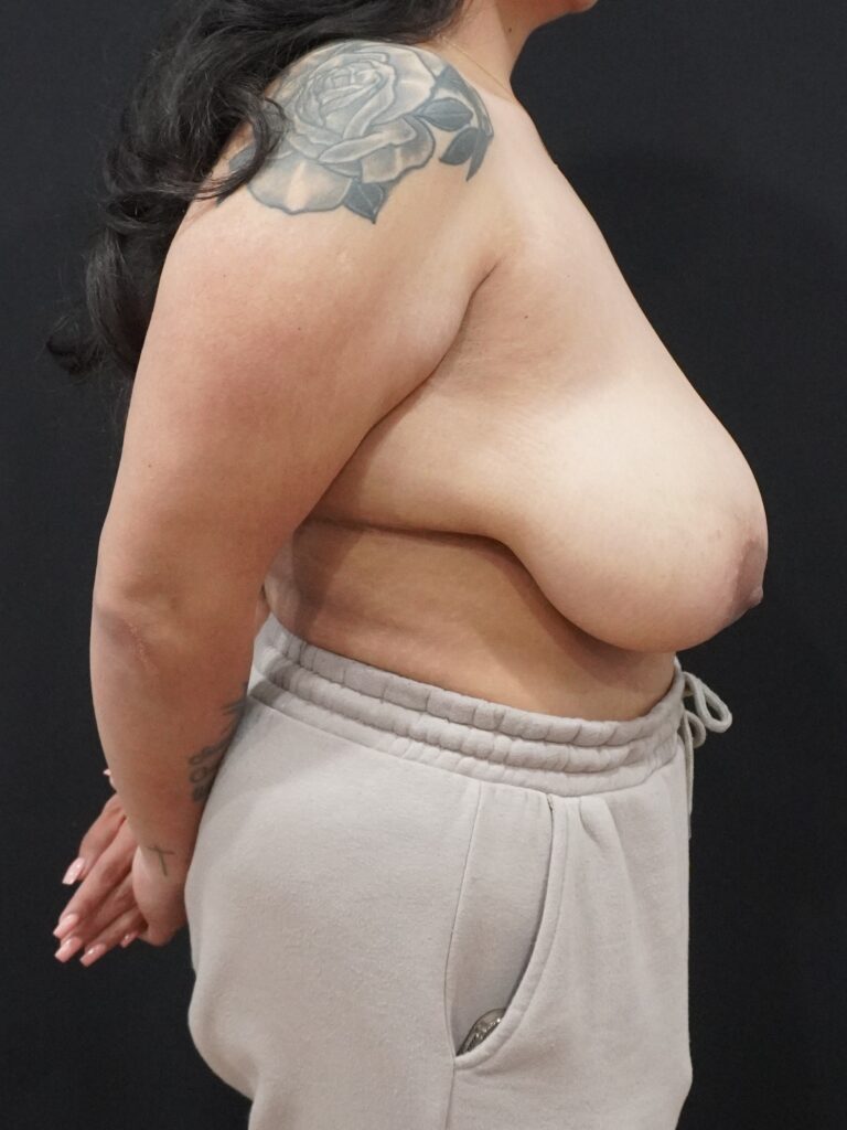 Before Image:  - right-side