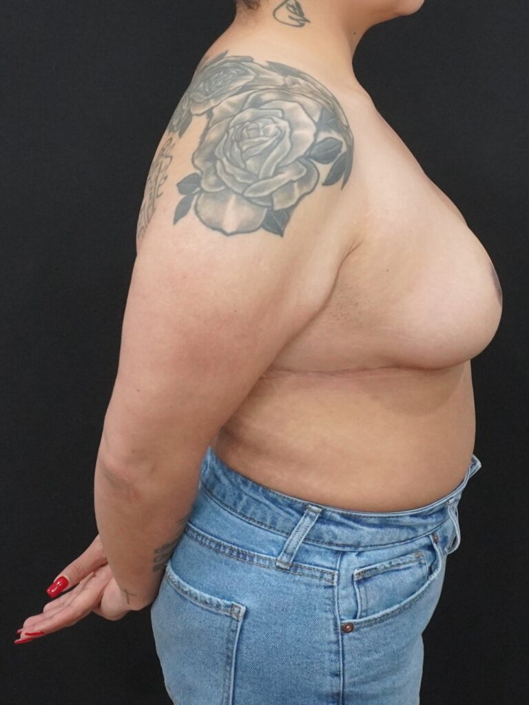After Image:  - right-side