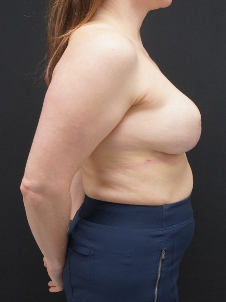 After Image:  - right-side