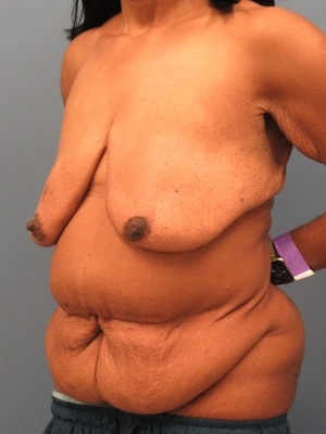 Before Image:  - left-front-oblique