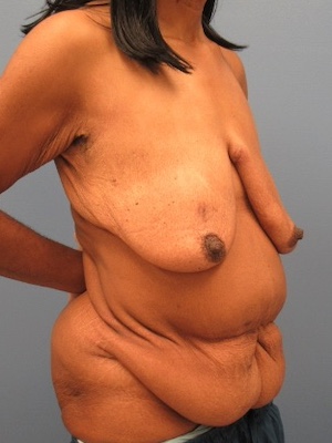 Before Image:  - right-front-oblique
