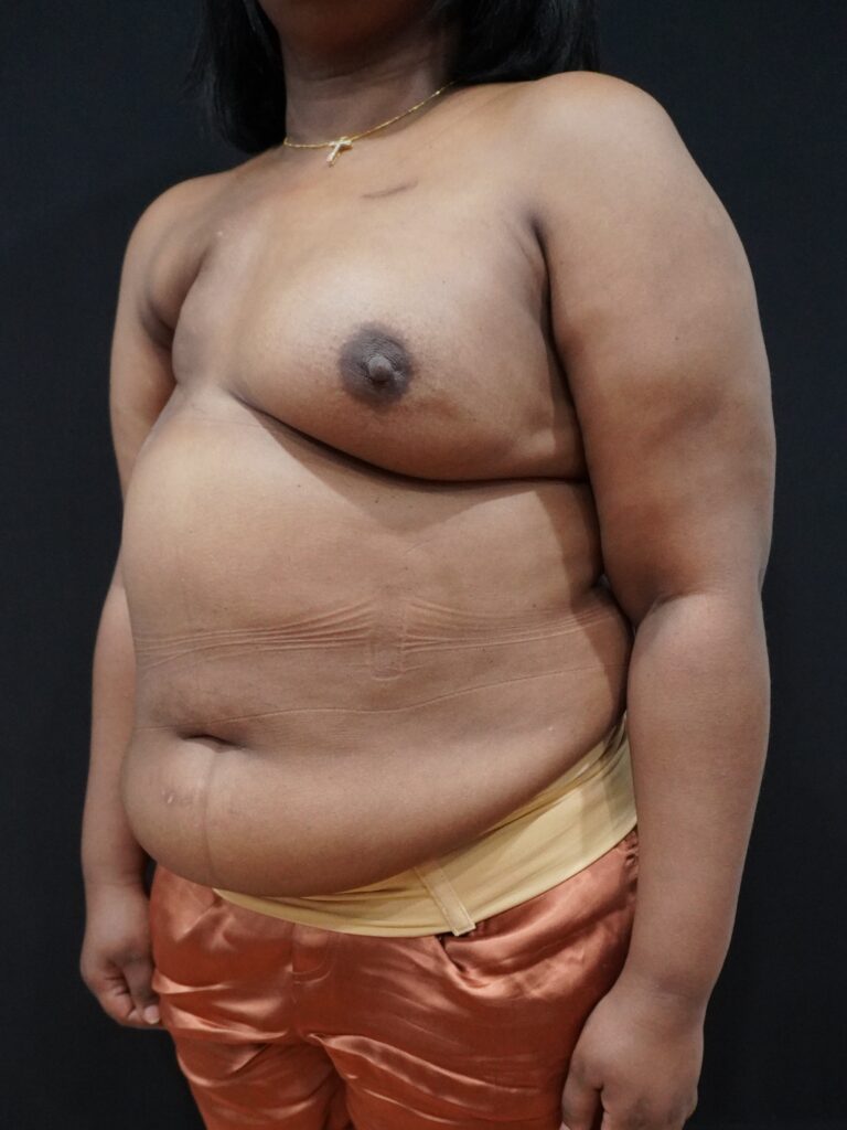Before Image:  - left-front-oblique