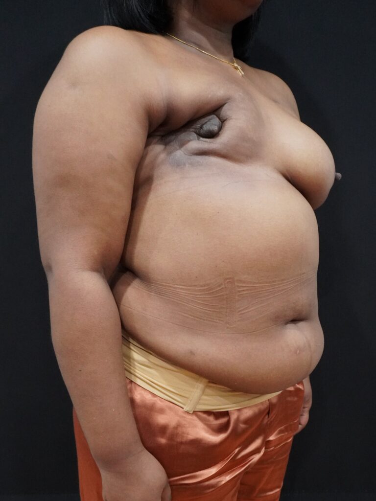 Before Image:  - right-front-oblique