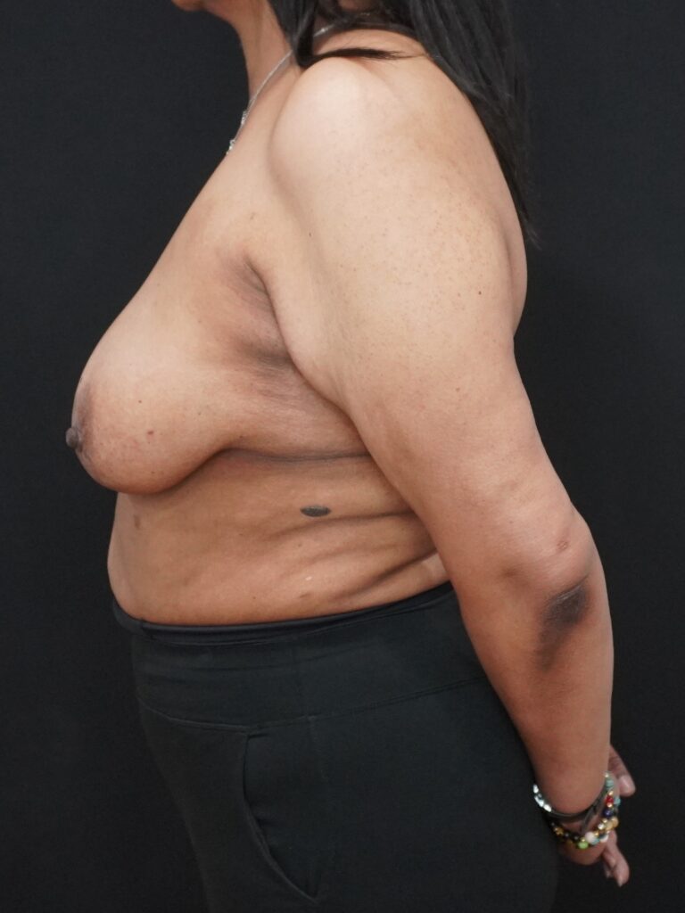 Before Image:  - left-side