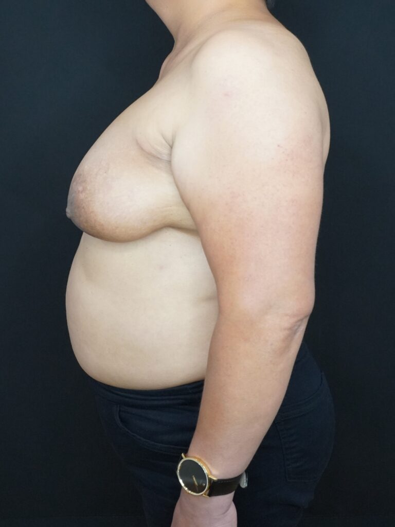 Before Image:  - left-side