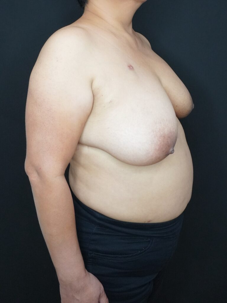 Before Image:  - right-front-oblique