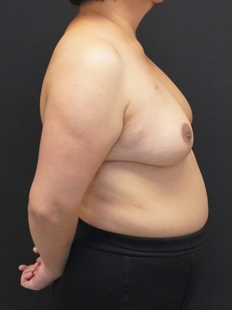 After Image:  - right-side