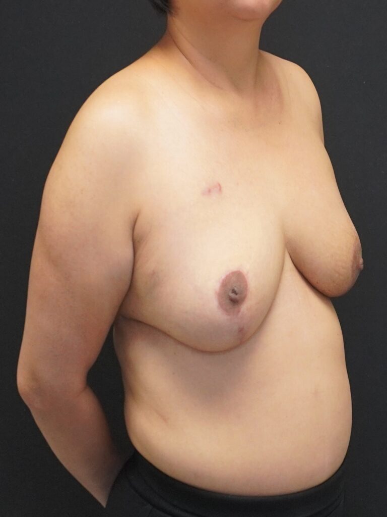 After Image:  - right-front-oblique