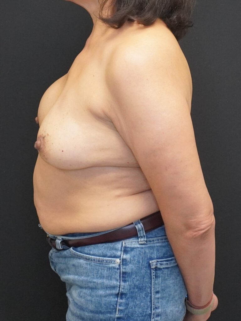 Before Image:  - left-side