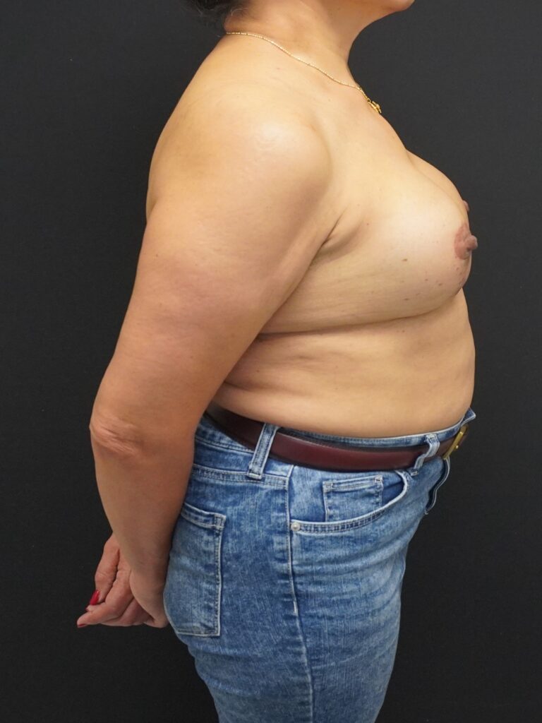 After Image:  - right-side