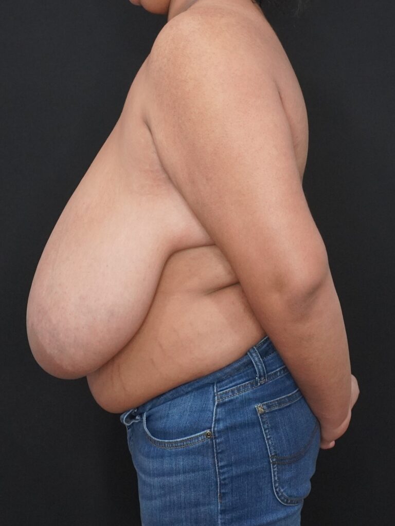 Before Image:  - left-side