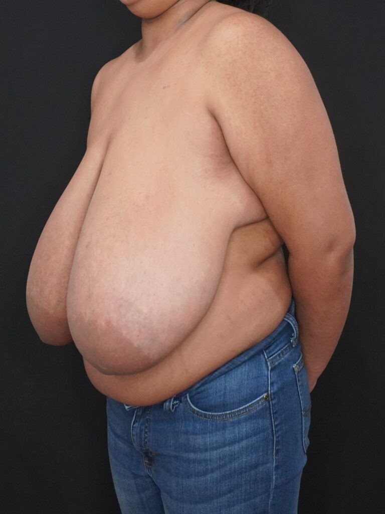 Before Image:  - left-front-oblique
