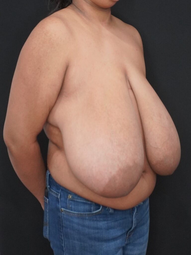 Before Image:  - right-front-oblique
