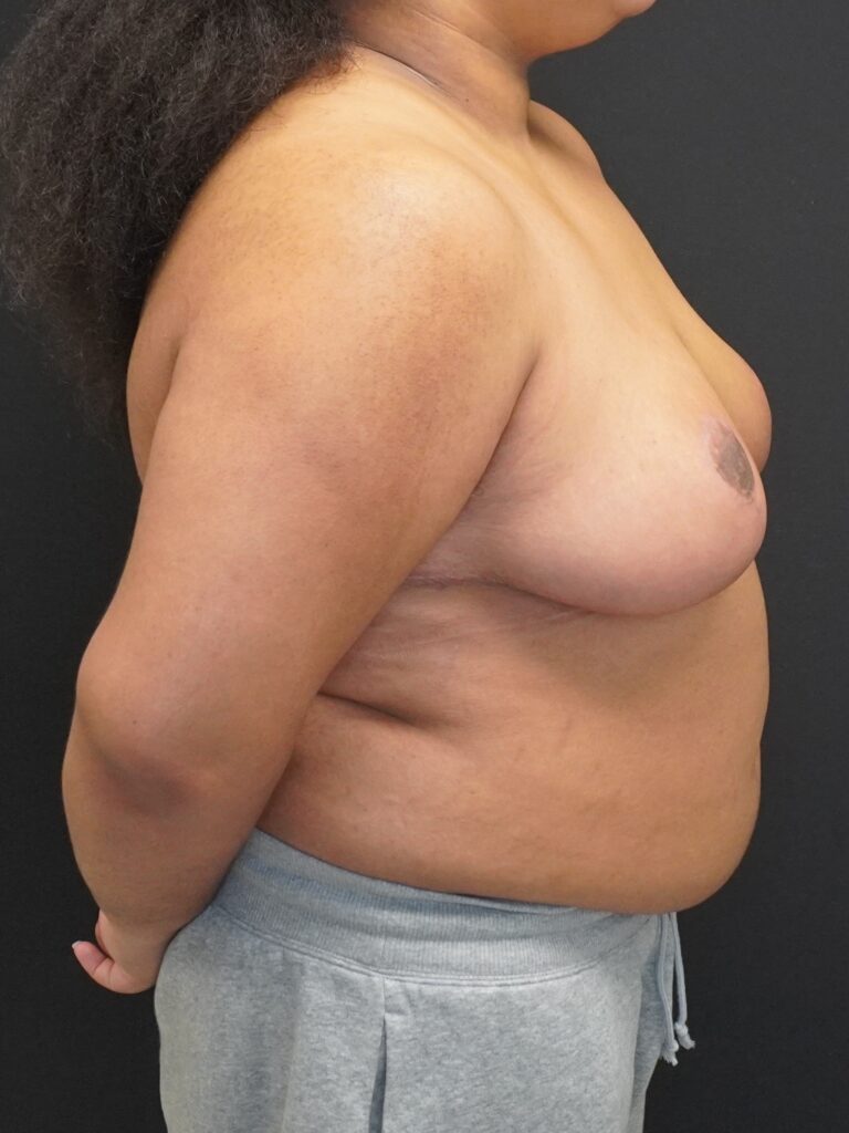 After Image:  - right-side