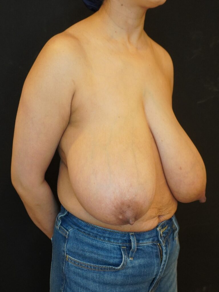 Before Image:  - right-front-oblique