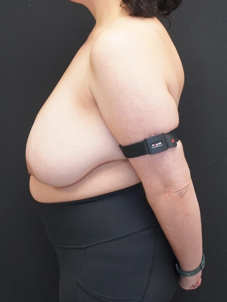 Before Image:  - left-side