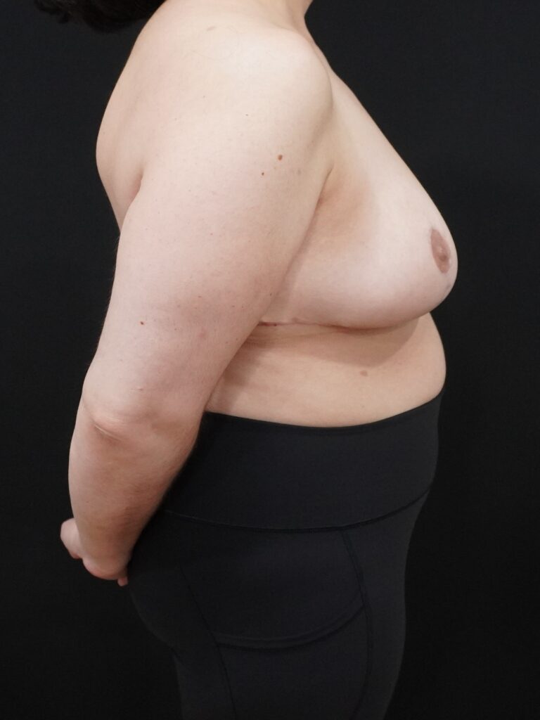 After Image:  - right-side