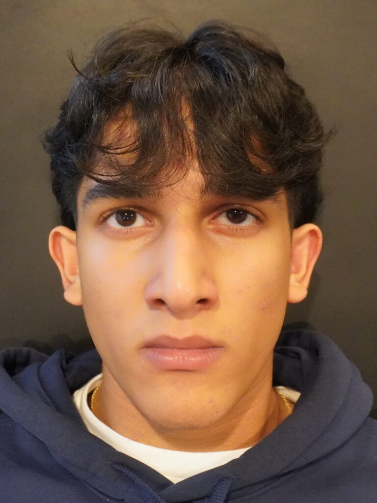 Before Image:  - front