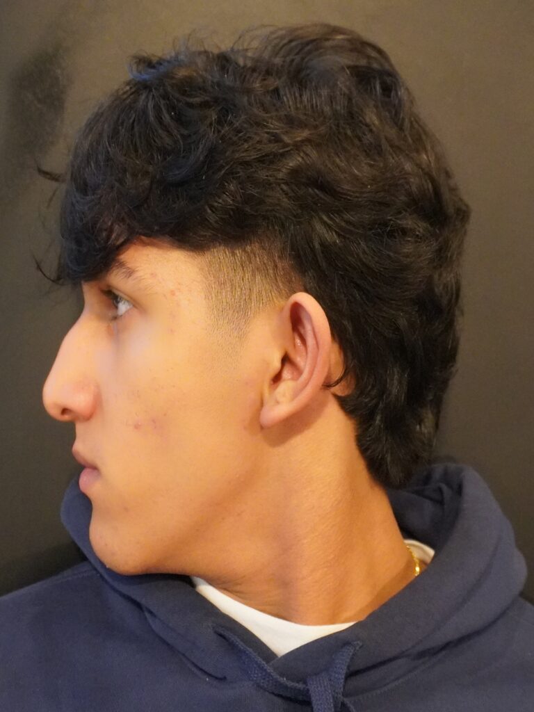 Before Image:  - left-side