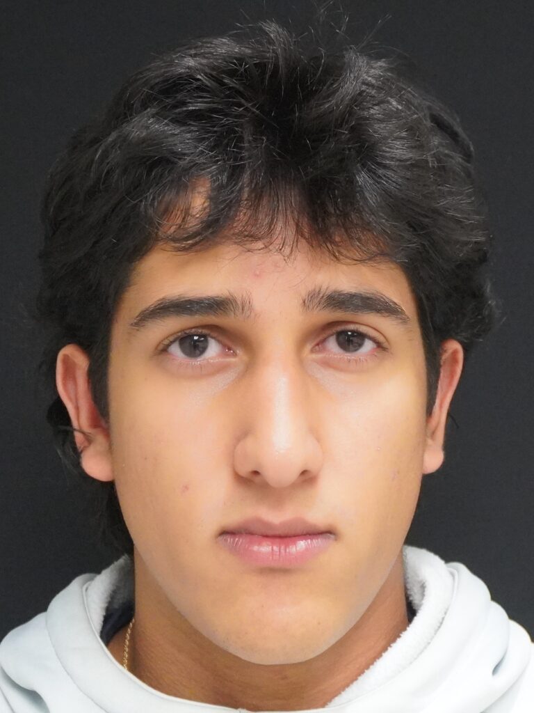 After Image:  - front