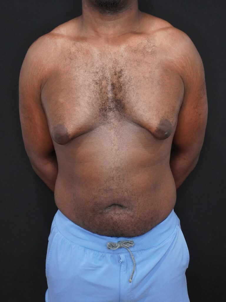 Before Image:  - front