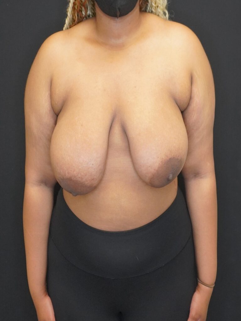 Before Image:  - front