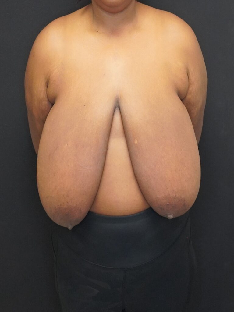 Before Image:  - front